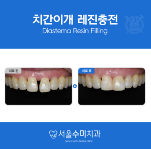 회현역치과